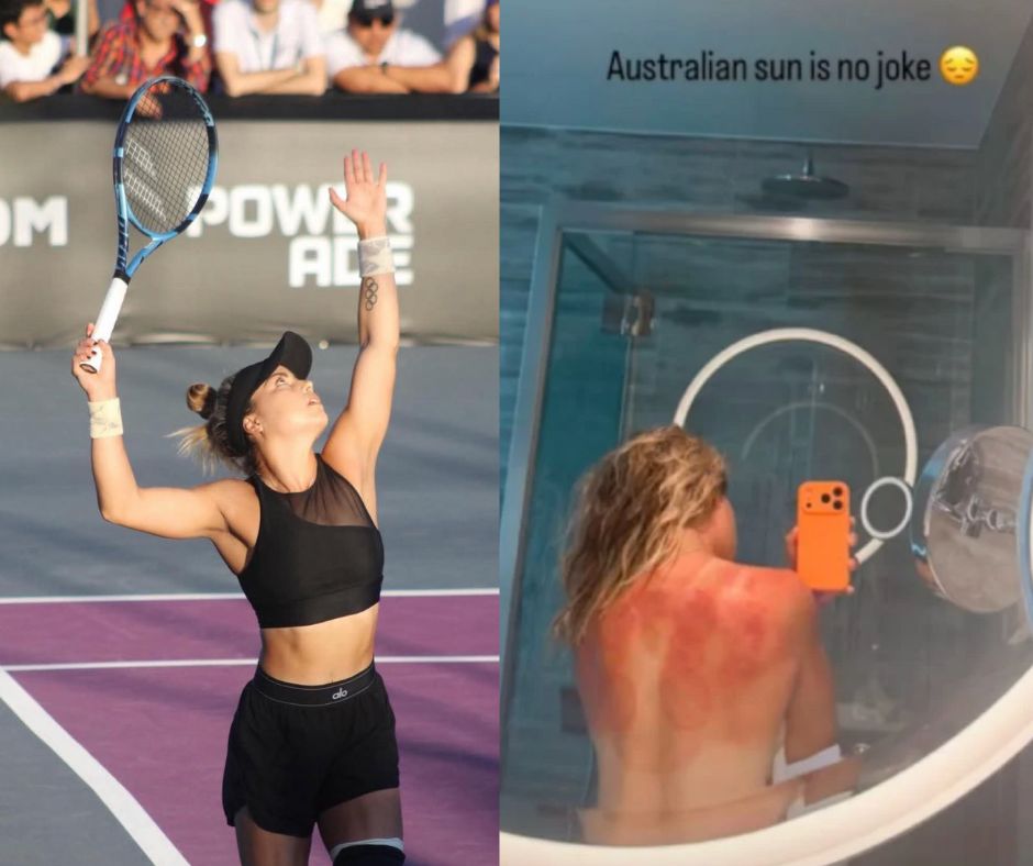 El sol de Australia no es una broma: Renata Zarazúa denuncia las causas del impacto del sol en Hobart